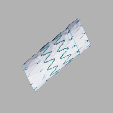 Zenith TX2® TAA Endovascular Graft with Pro-Form® Proximal Extensions