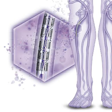 XIENCE Prime BTK Everolimus Eluting Stent