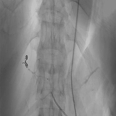 Merit Maestro® Microcatheters